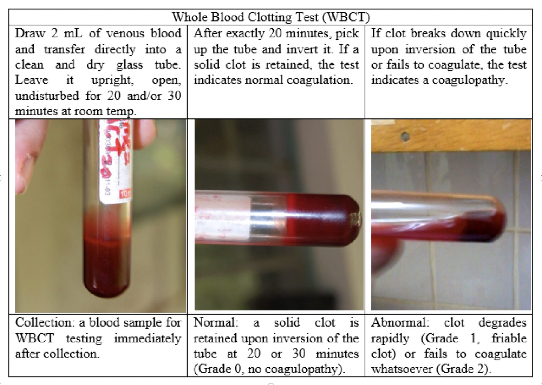 1 Blood Tests